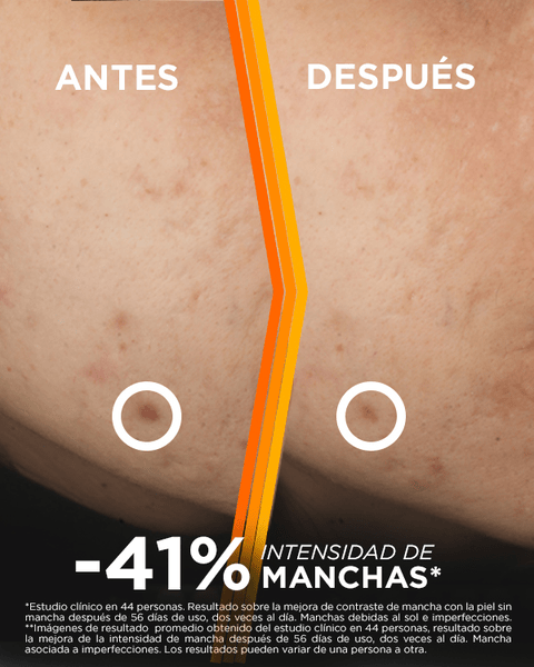 serum antimanchas express aclara garnier